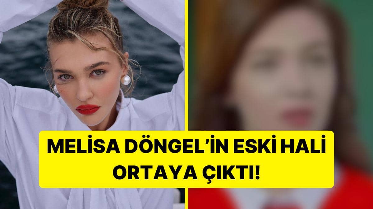 Eski Hali Ortaya Çıktı! Kirli Sepeti’nin Aylin’i Melisa Döngel’in Estetiksiz Görüntüsü Şaşırttı